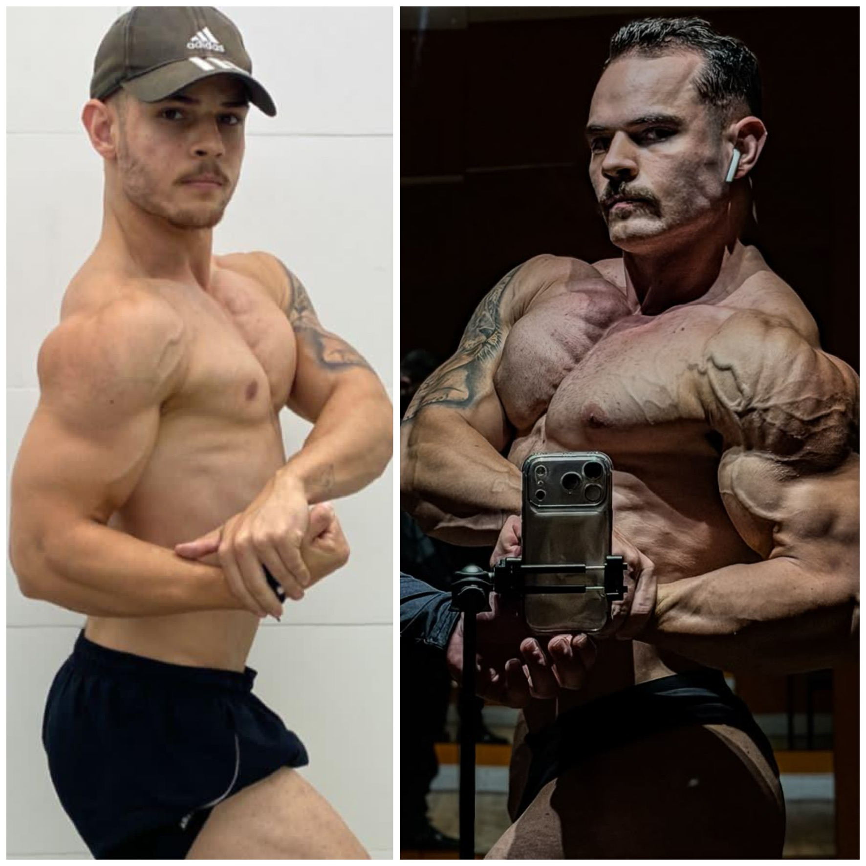 Evolução real de paciente 1